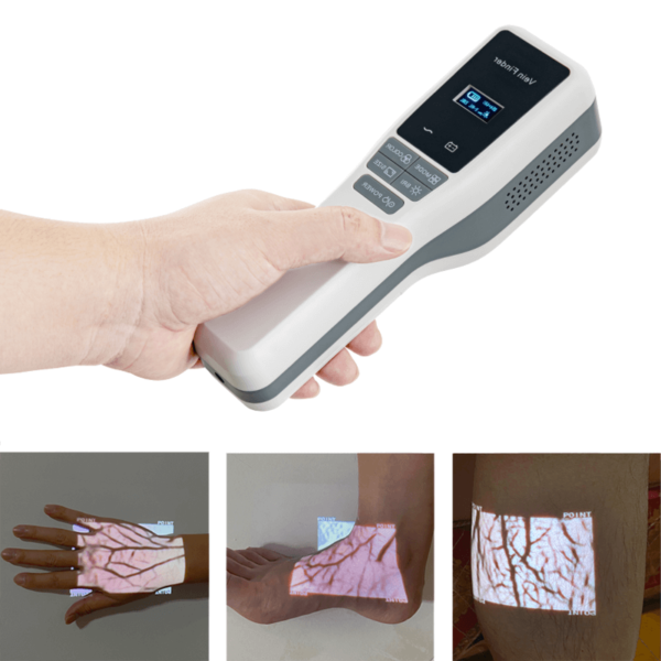 Anchoring the vein everything you need to know