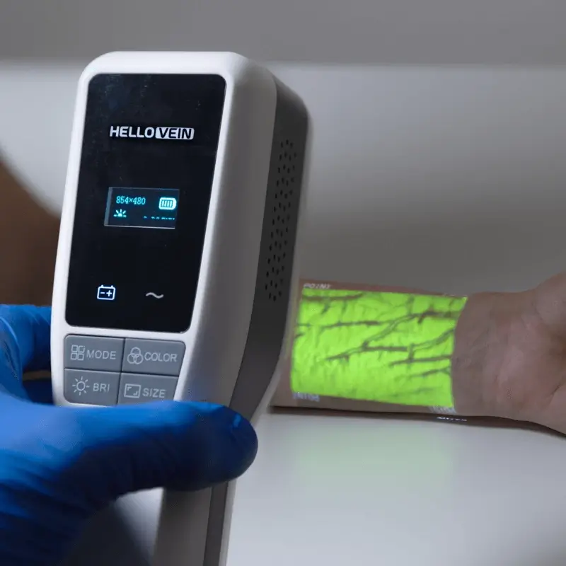 A nurse is using HelloVein to locate veins on a patient’s wrist.