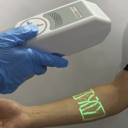 hellovein-vein-finder-301