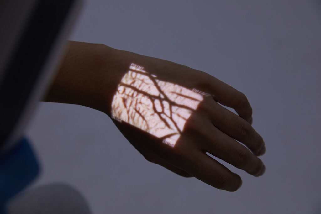 HelloVein projecting green vein pattern on fingers with ease.