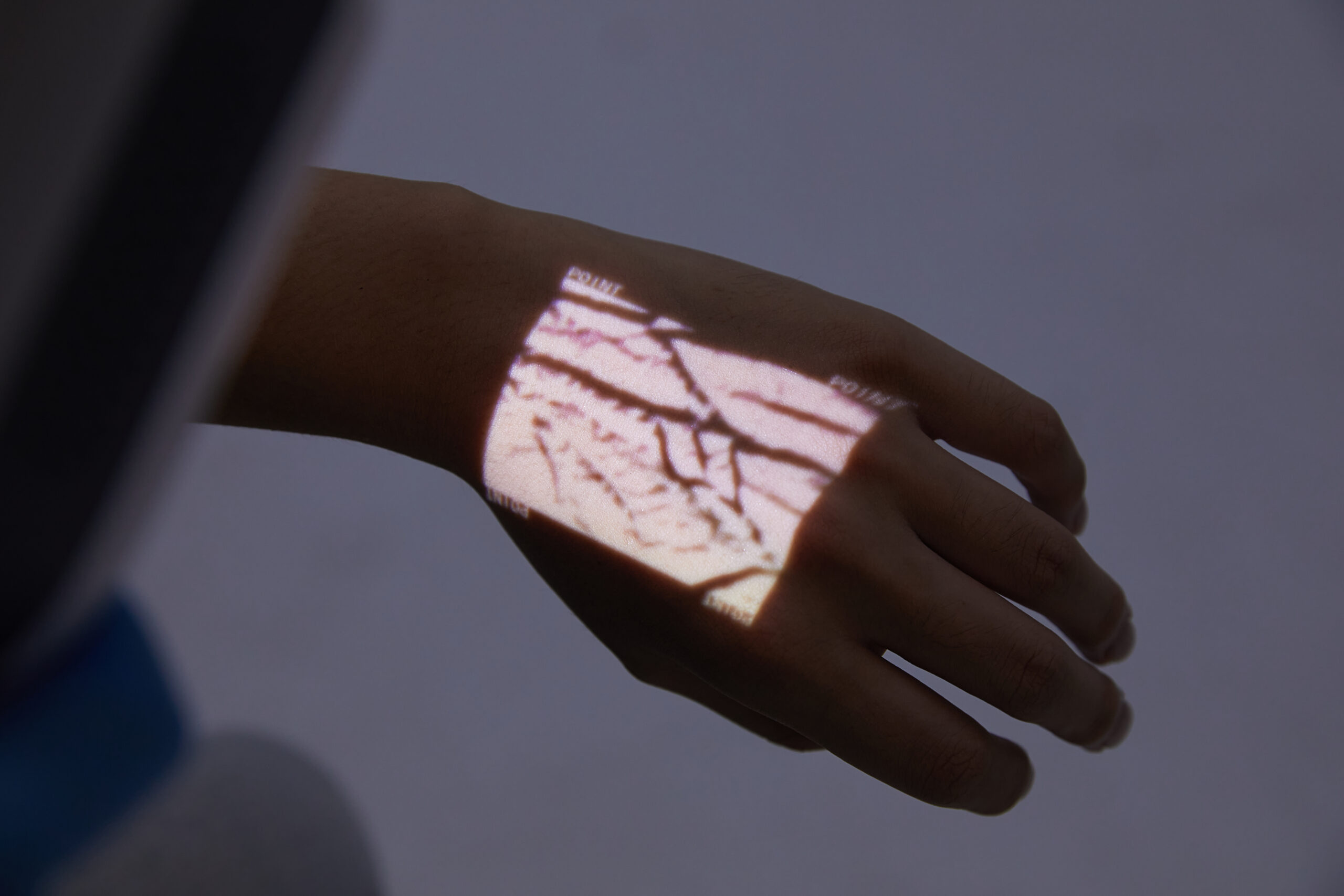 HelloVein projecting subtle vein pattern on hand in dim light