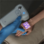 AimVein Pro 2.0 projette une lumière vasculaire focalisée sur le dos de la main pour mettre en évidence les contours des veines.