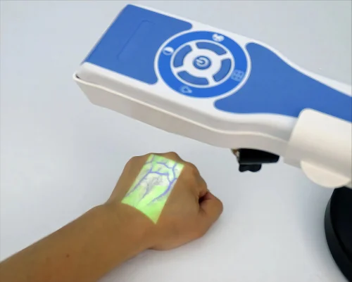 Le Pigeon DVA30 illumine les veines du dos de la main pour une visualisation claire.