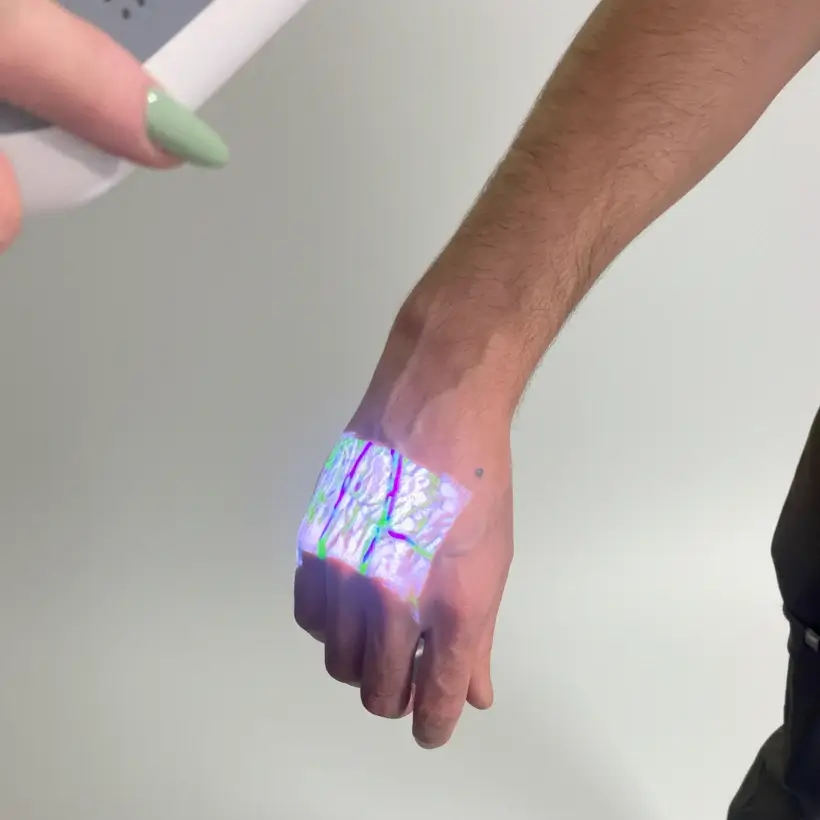 Hellovein Lite 2.0 held over the back of a hand to highlight veins for clinical procedures.