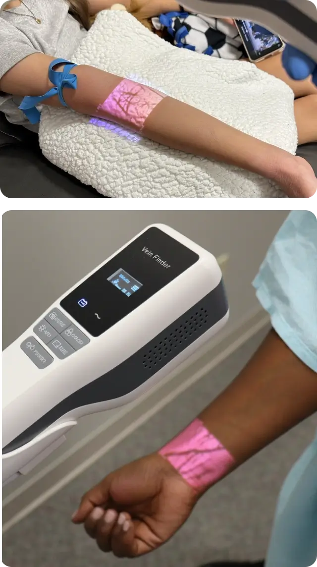 Hellovein Lite 2.0 Arm-Szenen