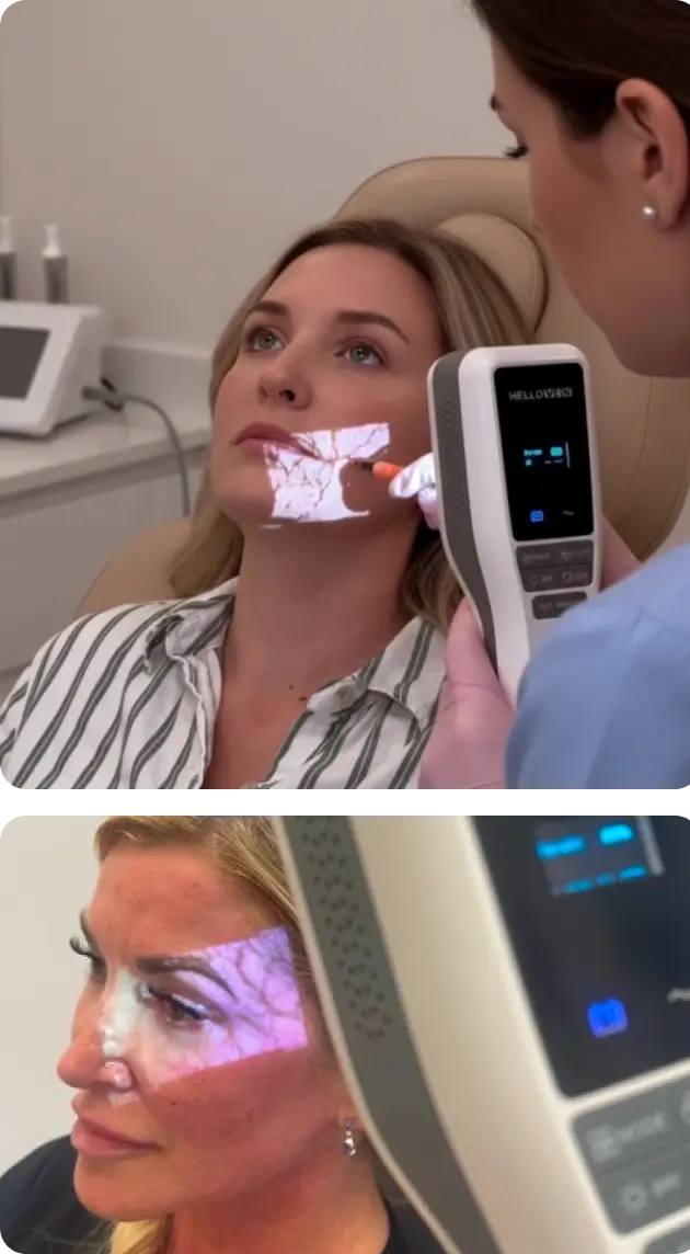 Gesichtsbeleuchtung für ästhetische Zwecke - Hellovein Lite 2.0