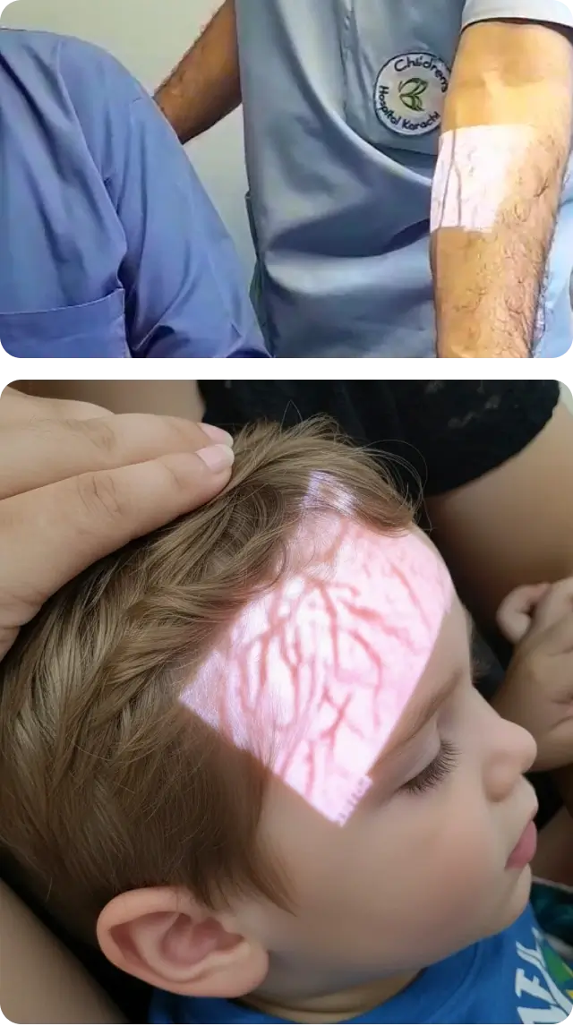 Hellovein Lite 2.0 Stirn- und Armansichten