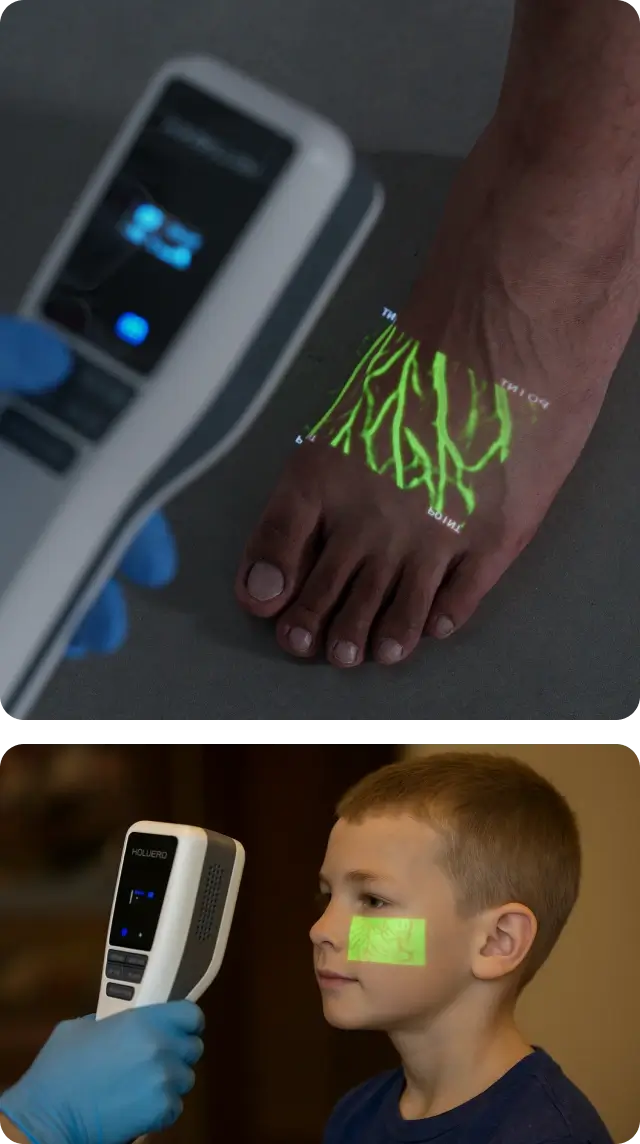 Hellovein Lite 2.0 Venensucher für Fuß und pädiatrisches Gesicht