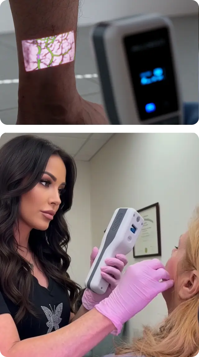 Hellovein Lite 2.0 Knöchel- und Gesichtsvenenanzeige