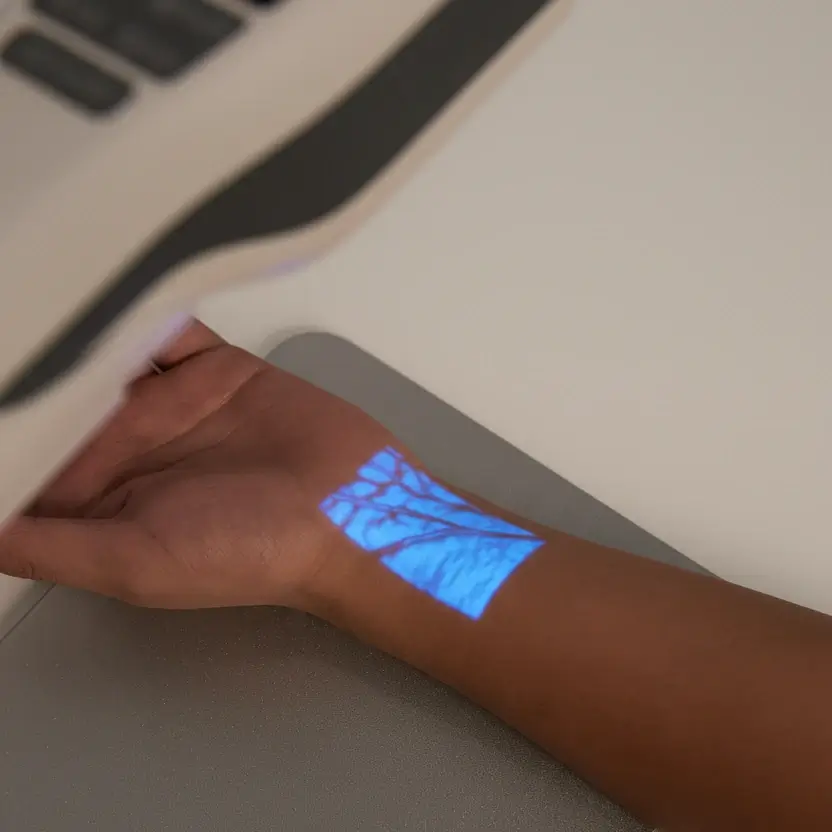 Hellovein Lite 2.0 placed over the arm to support clearer vein observation.