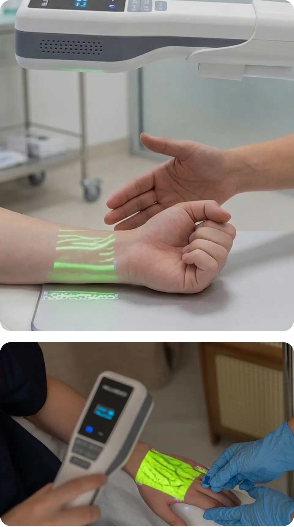 The Hellovein Lite 2.0 Vein Finder is projecting a green vein image onto the patient’s hand.