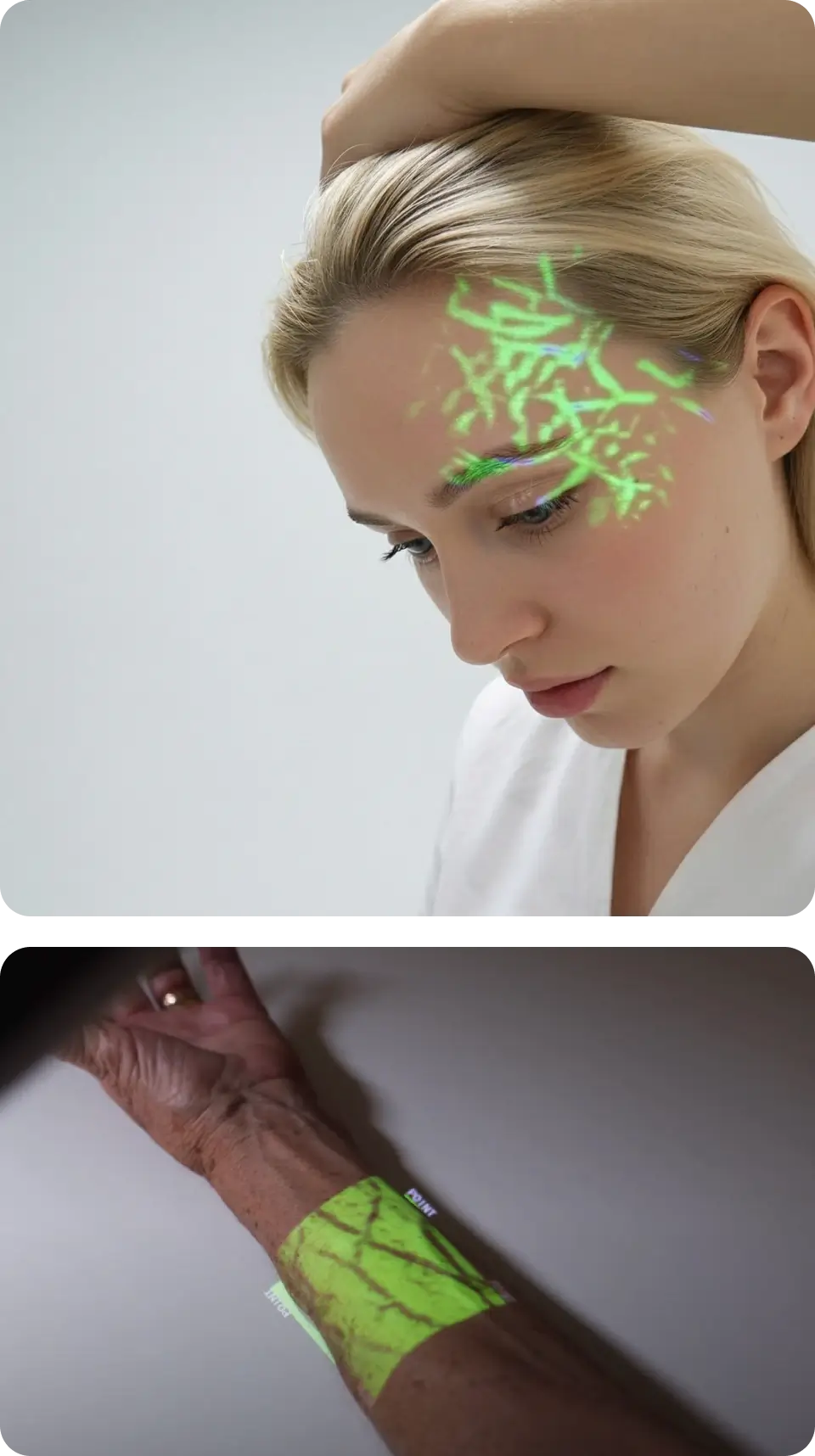 The Hellovein Lite 2.0 Vein Finder is projecting the patient’s facial and hand veins