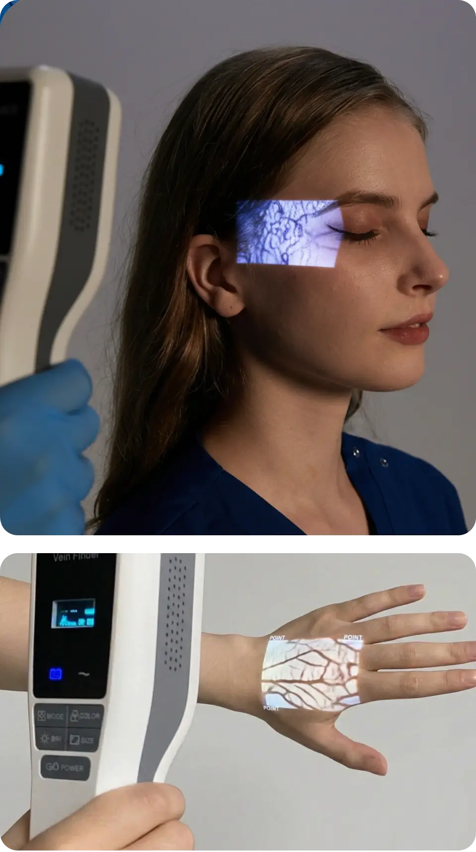 The Hellovein Lite 2.0 Vein Finder is projecting the patient’s facial and hand veins as white vein images.
