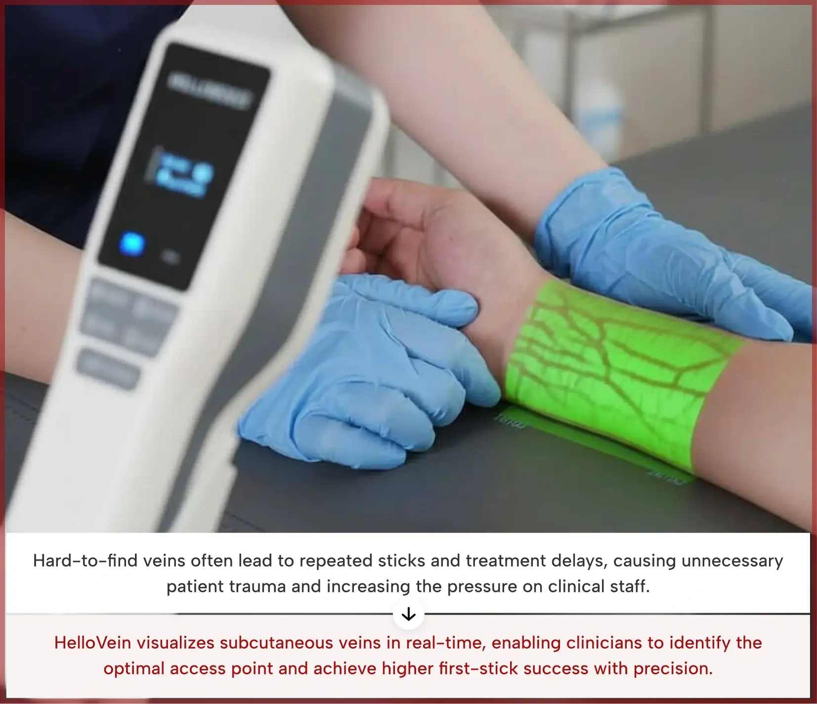 HelloVein for IV Access