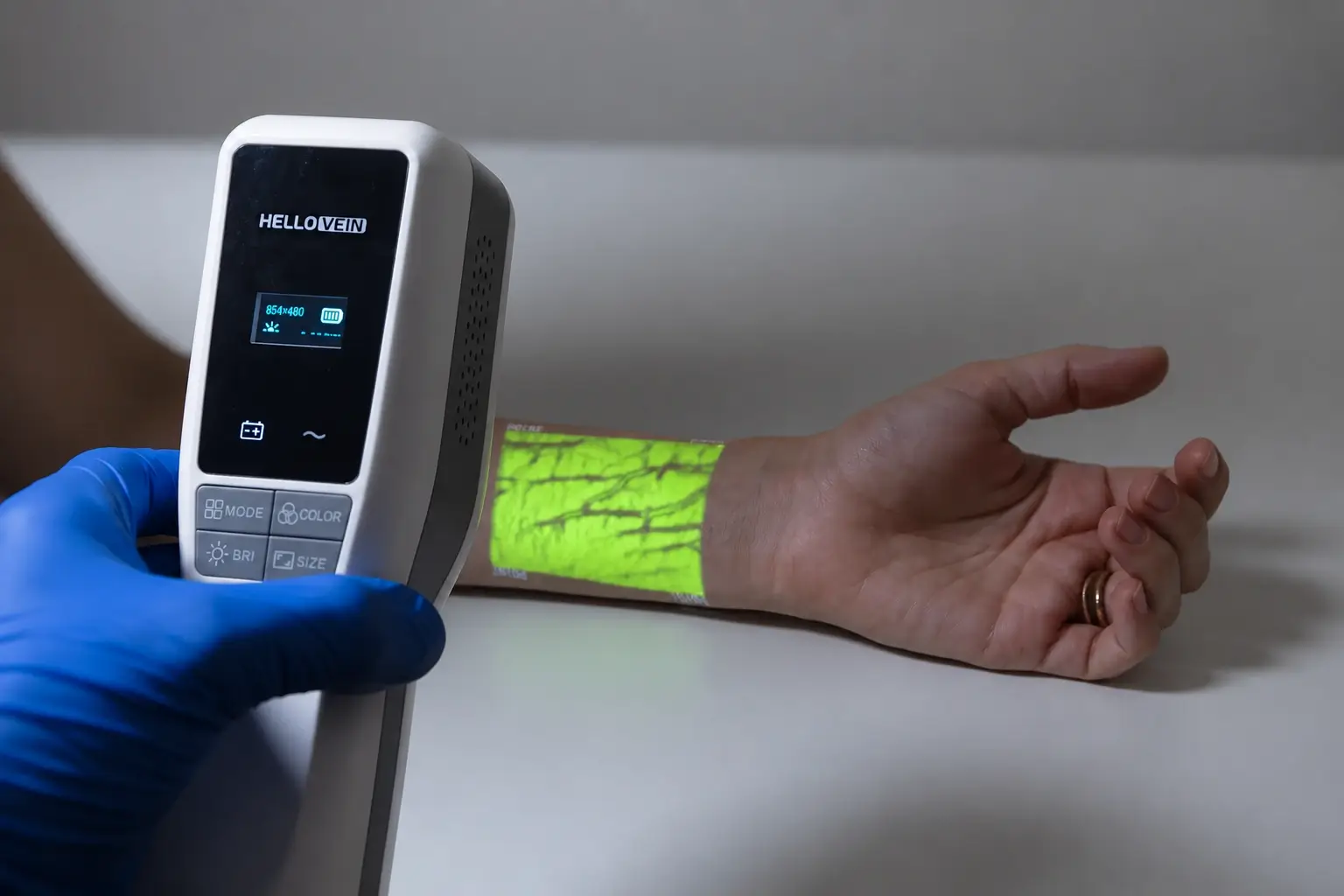 HelloVein Lite 2.0 in clinical use