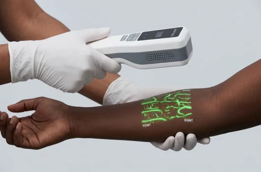 The Hellovein Lite 2.0 Vein Finder displays the hand veins of a Black patient in green.