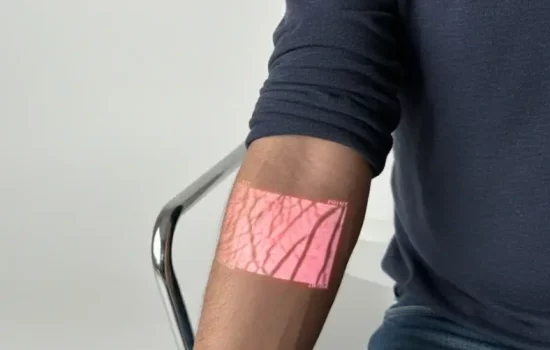 Hellovein Lite 2.0 projette une lumière rouge sur le bras du patient pour révéler clairement les veines.